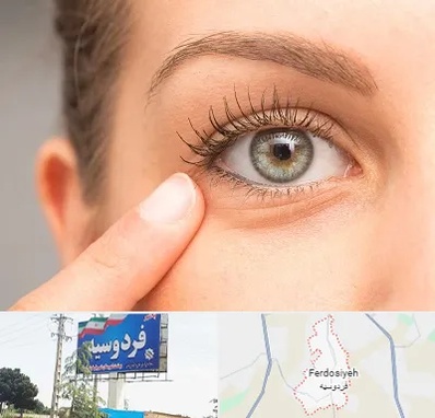 جراح پف چشم در فردوسیه شهریار
