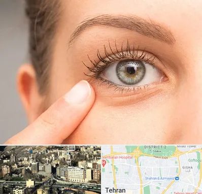 جراح پف چشم در مرزداران 