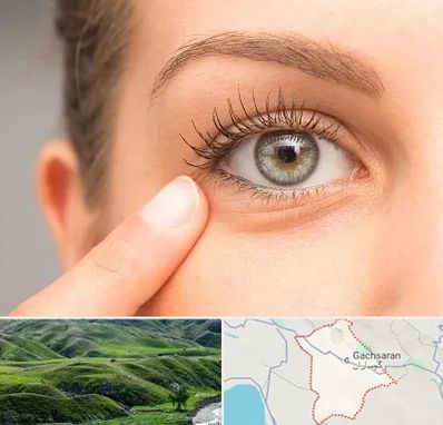جراح پف چشم در گچساران