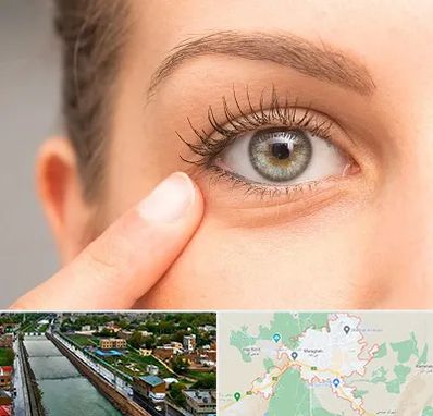 جراح پف چشم در مراغه