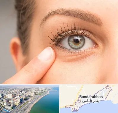 جراح پف چشم در بندرعباس