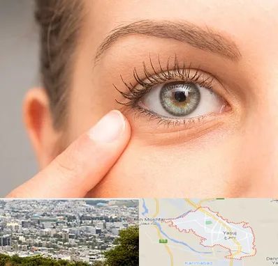 جراح پف چشم در یاسوج