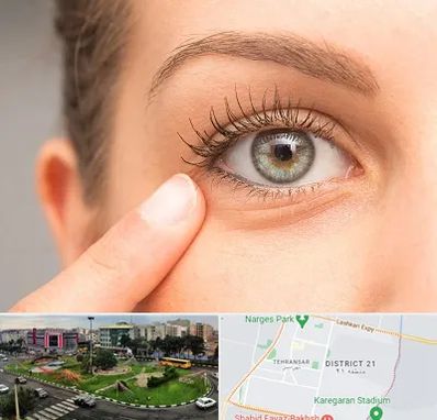 جراح پف چشم در تهرانسر 