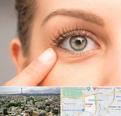 جراح پف چشم در گیشا 