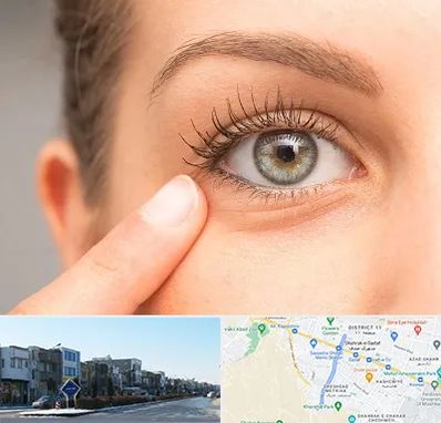 جراح پف چشم در شریعتی مشهد