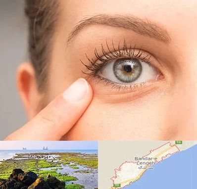 جراح پف چشم در بندرلنگه