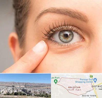 جراح پف چشم در شهرک گلستان شیراز
