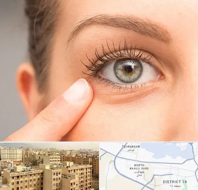 جراح پف چشم در جنوب غرب تهران