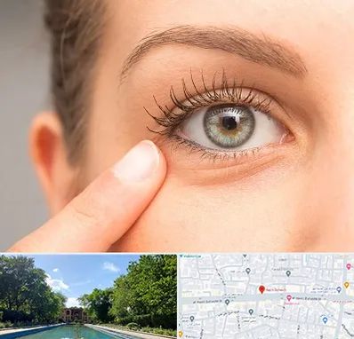 جراح پف چشم در هشت بهشت اصفهان