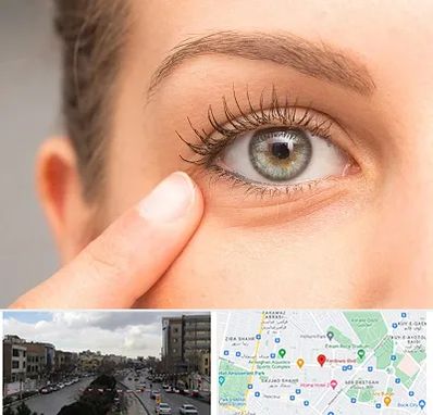 جراح پف چشم در بلوار فردوسی مشهد 