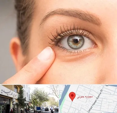 جراح پف چشم در مجیدیه جنوبی