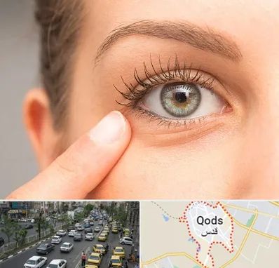 جراح پف چشم در شهر قدس