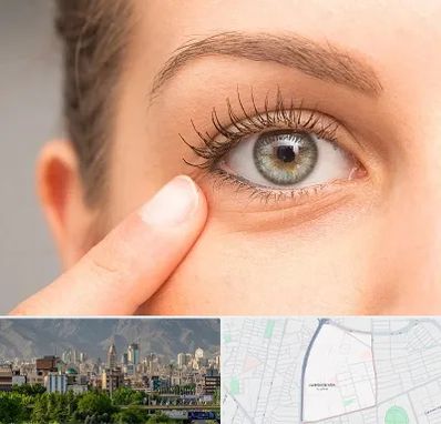 جراح پف چشم در جمشیدیه