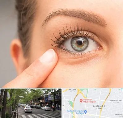 جراح پف چشم در ظفر 