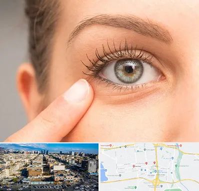 جراح پف چشم در شهرک راه آهن