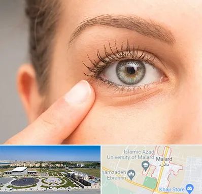 جراح پف چشم در ملارد