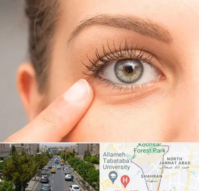 جراح پف چشم در شهران 