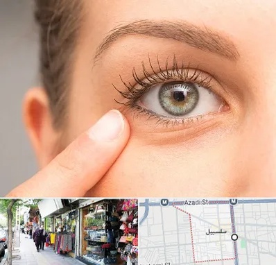 جراح پف چشم در سلسبیل
