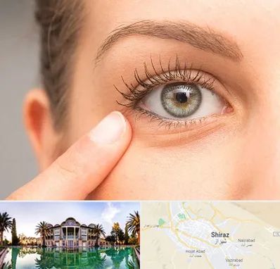 جراح پف چشم در شیراز