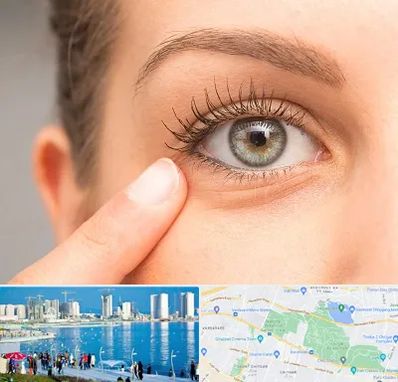 جراح پف چشم در چیتگر 