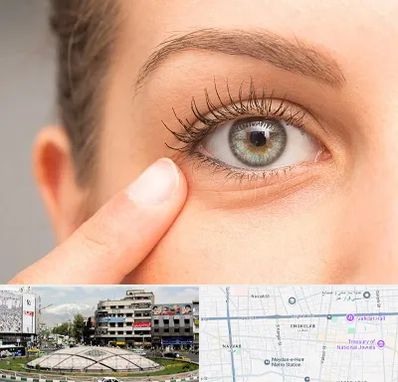 جراح پف چشم در مرکز تهران