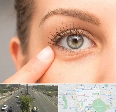 جراح پف چشم در منطقه 17 تهران 