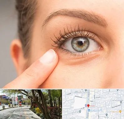 جراح پف چشم در خیابان توحید اصفهان