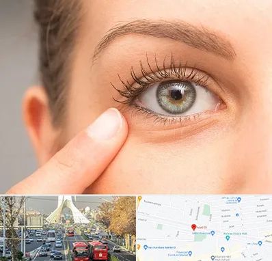 جراح پف چشم در خیابان آزادی 