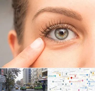 جراح پف چشم در فاطمی 