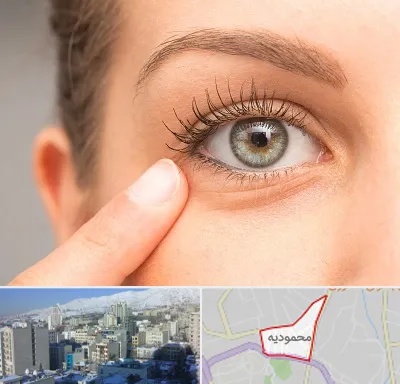 جراح پف چشم در محمودیه