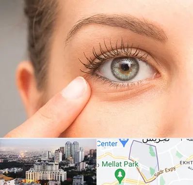 جراح پف چشم در الهیه 