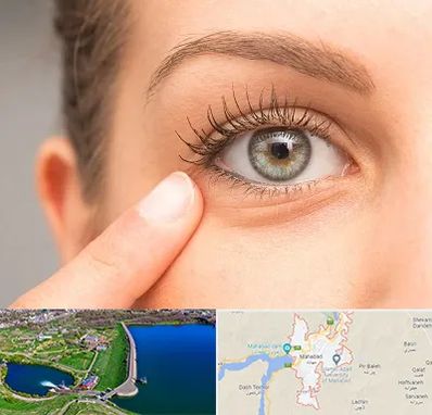 جراح پف چشم در مهاباد