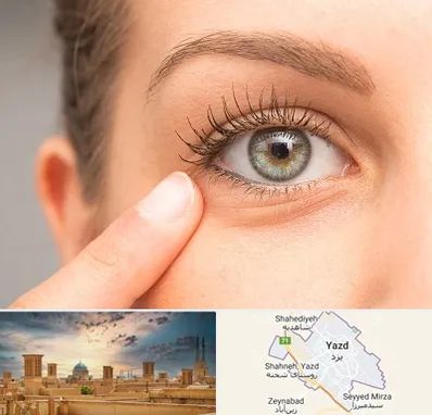 جراح پف چشم در یزد