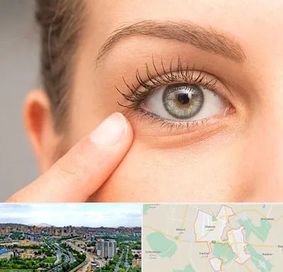 جراح پف چشم در شهریار