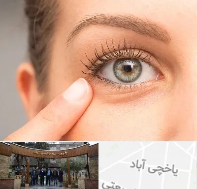 جراح پف چشم در یاخچی آباد