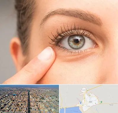 جراح پف چشم در بندر ماهشهر