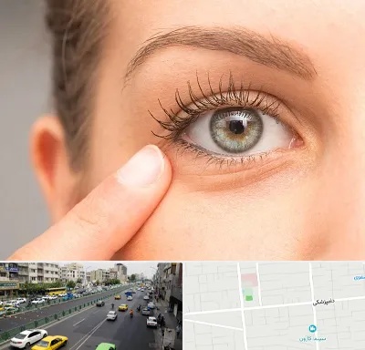 جراح پف چشم در خیابان دامپزشکی