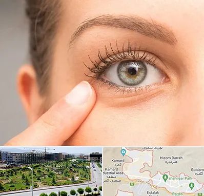 جراح پف چشم در پردیس