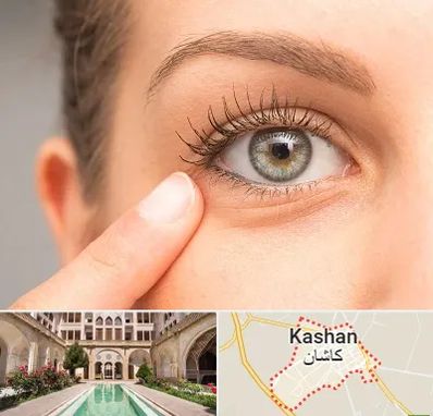 جراح پف چشم در کاشان