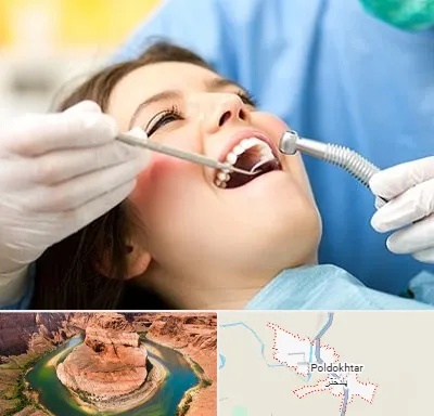 کلینیک دندانپزشکی در پلدختر