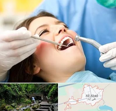 کلینیک دندانپزشکی در علی آباد کتول