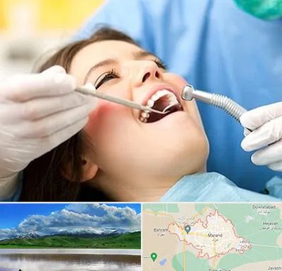 کلینیک دندانپزشکی در مرند