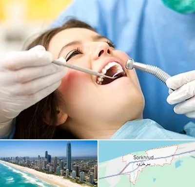 کلینیک دندانپزشکی در سرخرود