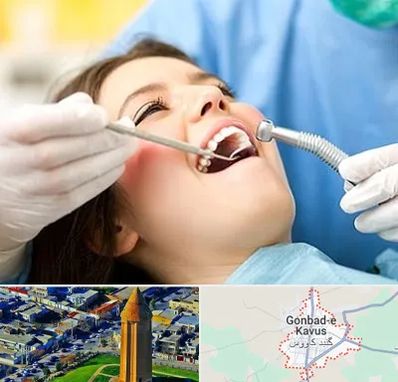 کلینیک دندانپزشکی در گنبد کاووس