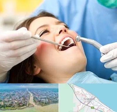 کلینیک دندانپزشکی در تنکابن