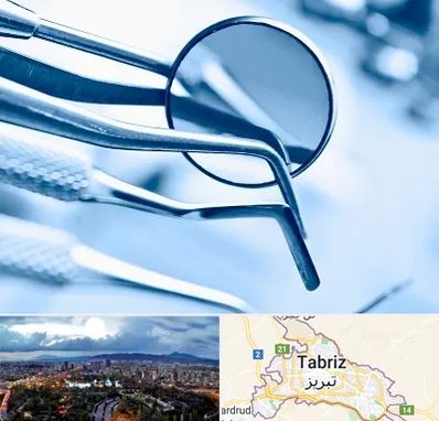 تجهیزات دندانپزشکی در تبریز