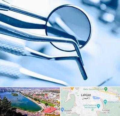 تجهیزات دندانپزشکی در لاهیجان