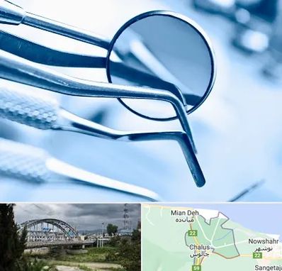 تجهیزات دندانپزشکی در چالوس