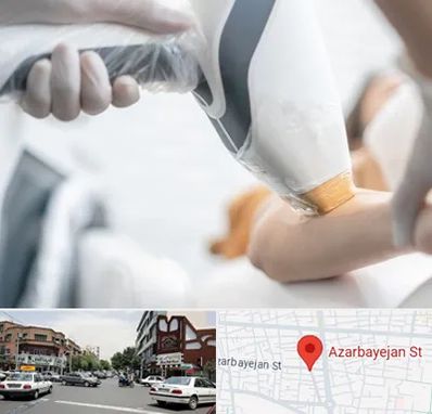 تجهیزات پزشکی زیبایی در خیابان آذربایجان