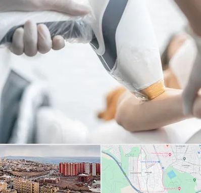 تجهیزات پزشکی زیبایی در سهند تبریز